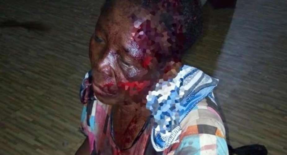 Group Condemns Near-Lynching Of 60-Year-Old Woman At Sumpini