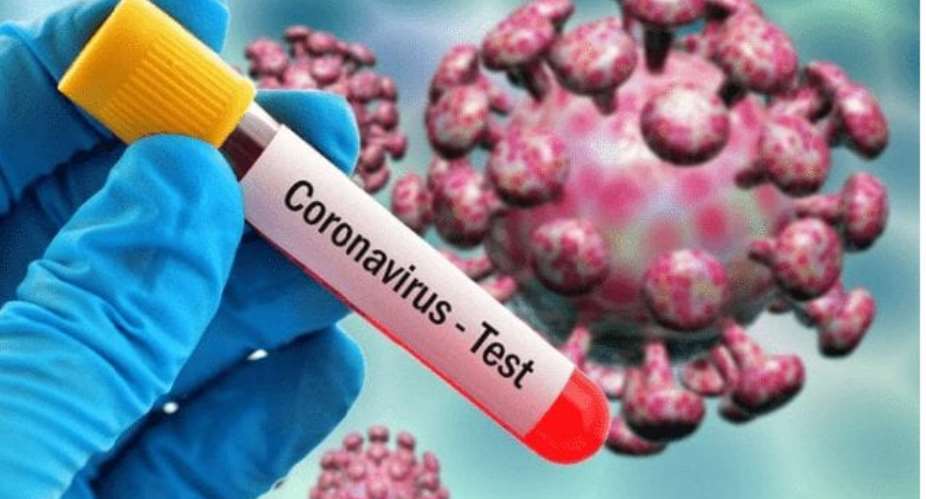 Covid-19 situation now dire; scale up free, enhanced testing – GMA to govt