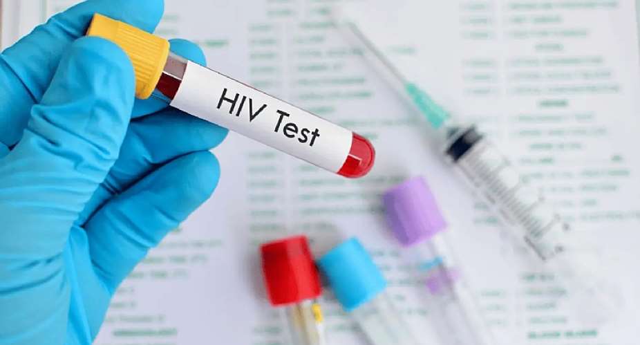 AIDS Commission explains why more women test HIV positive than men