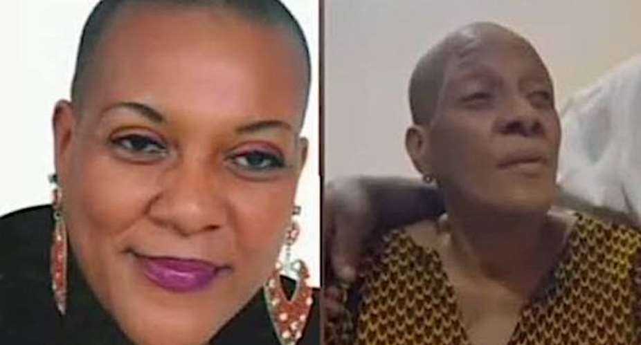 Actress Maureen Okpoko Solicits Financial Assistance To Tackle Blindness