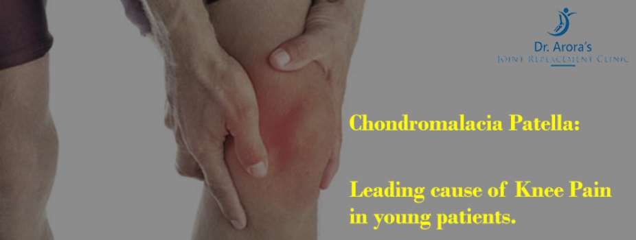 Chondro-malacia Patella Most common cause of knee pain in young individuals.
