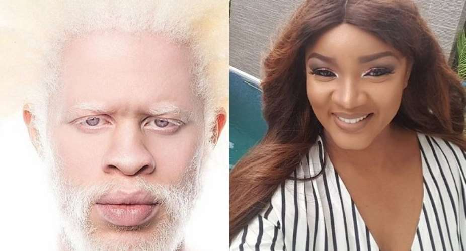 Actress, Omotola Jalade Fumes over Hate on Albinos