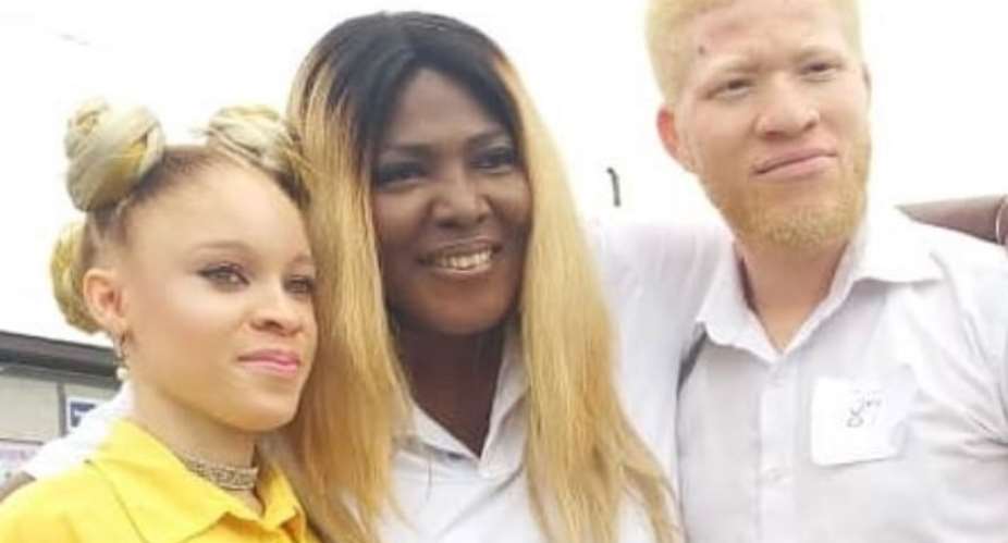 Actress, Ronnie Dikko Joins UVcare Edwinin Albinism Awareness Campaign photos