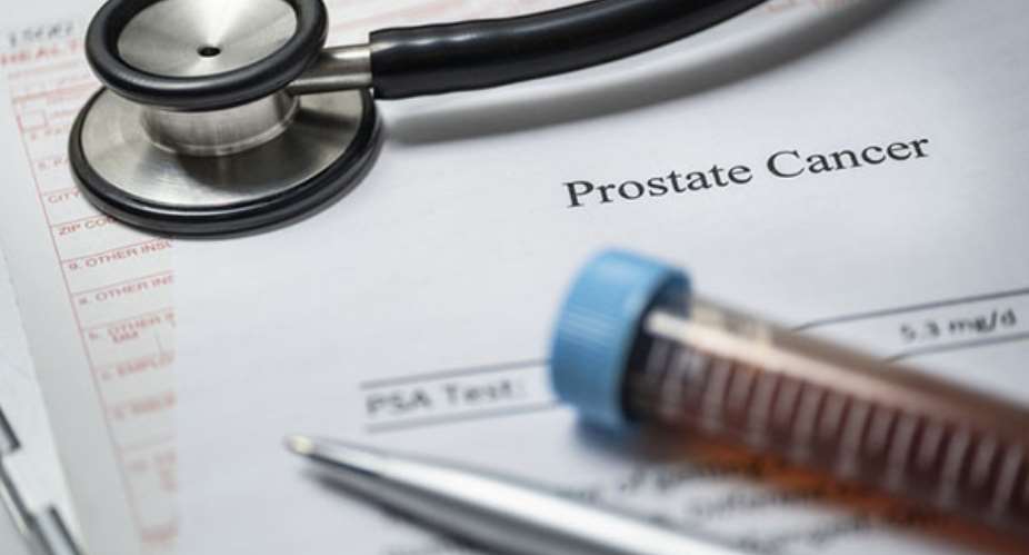234 males died from prostate cancer between 2013 and 2022 — Report reveals