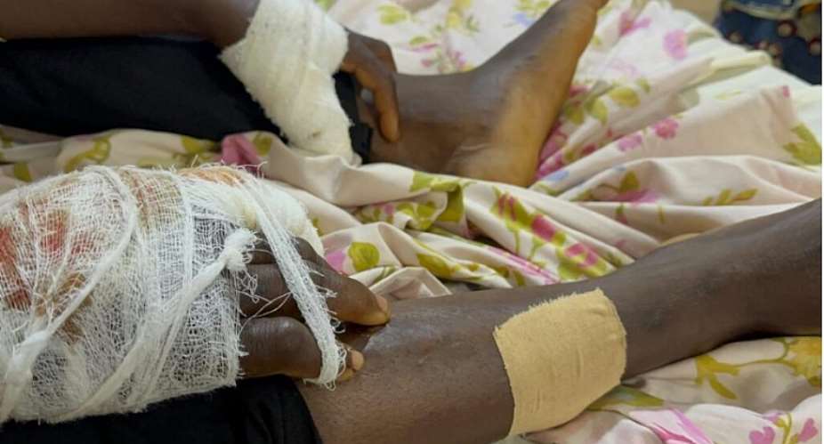 Kenyasi man allegedly attacked by prison officers and inmates over yam theft claim