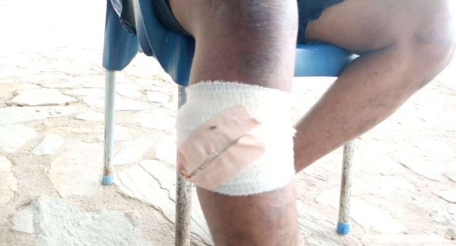 CR: Landguards Shoot Asafo Chief, Three Others Badly Injured