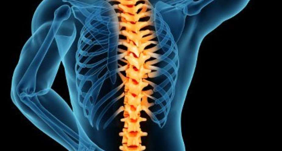Ghanaians urged to regularly check their spine