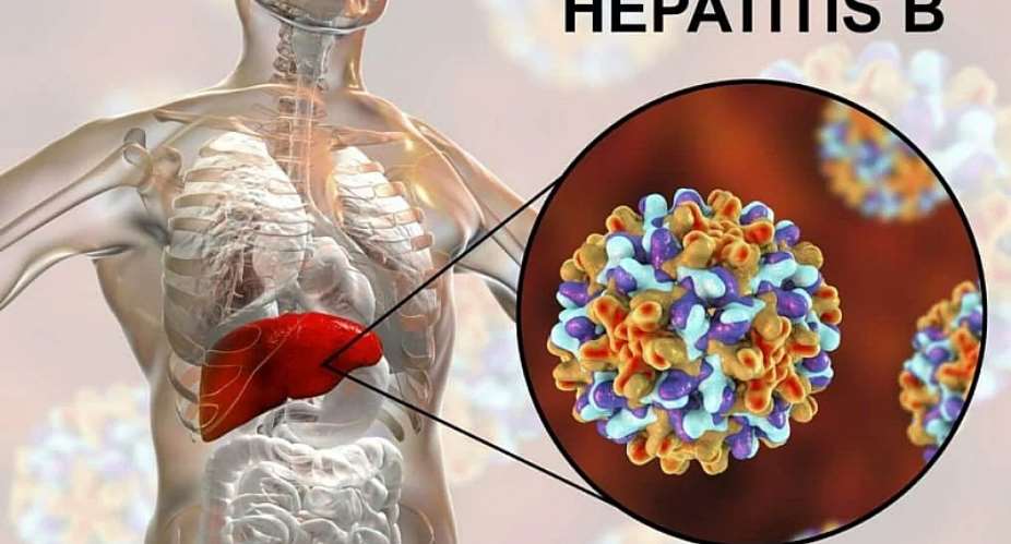Hepatitis B in Ghana: A Silent Epidemic Lurking in the Shadows