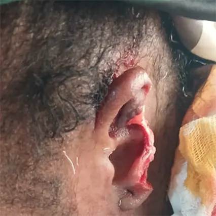 Victim showing her bitten ear