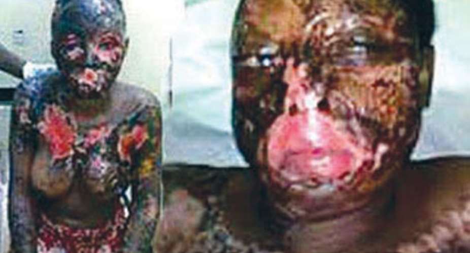 Man In Court For Pouring Acid On Wife