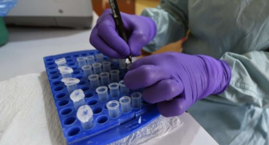 A health official works at the Lassa Fever Research and Control in Irrua Specialist Teaching Hospital in midwest Nigeria, in 2018.  By PIUS UTOMI EKPEI (AFP/File)
