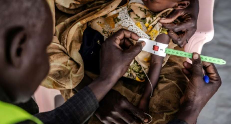 A health worker measures a Sudanese child's arm at a clinic in Renk, in neighbouring South Sudan.  By LUIS TATO (AFP/File)