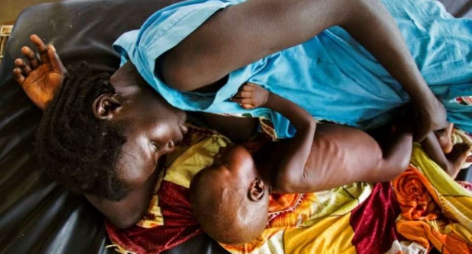A mother breastfeeds her child who suffers acute malnutrition, at the clinic run by Doctors Without Borders MSF in Aweil, northern Bahr al-Ghazal, South Sudan.  By Albert Gonzalez Farran AFPFile