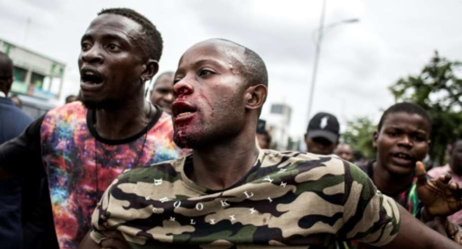 A young man was injured in the face after police fired warning shots to disperse worshippers outside Kinshasa cathedral.  By JOHN WESSELS AFP