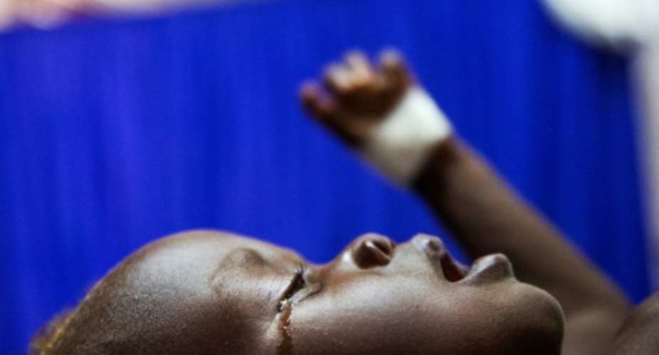 Achol Ri, a one-and-a-half year-old child with severe malnutrition, cries at a clinic run by Doctors Without Borders MSF in Aweil, South Sudan.  By Albert GONZALEZ FARRAN AFPFile