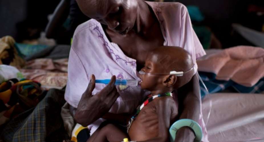 A child suffering severe malnutrition is fed by medical volunteers in Minkamman, South Sudan, on March 3, 2014.  By JM Lopez AFPFile