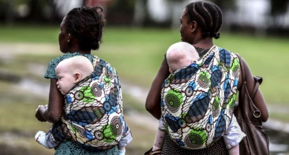 This image courtesy of the Milliyet Daily shows women carrying their albino children on May 5, 2014, in Dar es Salaam, Tanzania.  By Bunyamin Aygun Milliyet Daily  HOAFPFile