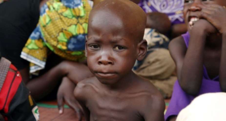 Around half of children under the age of five in the Lake Chad region -- 490,000 in total -- are suffering from acute, severe malnutrition, the UN has warned.  By Emmanuel Arewa AFPFile