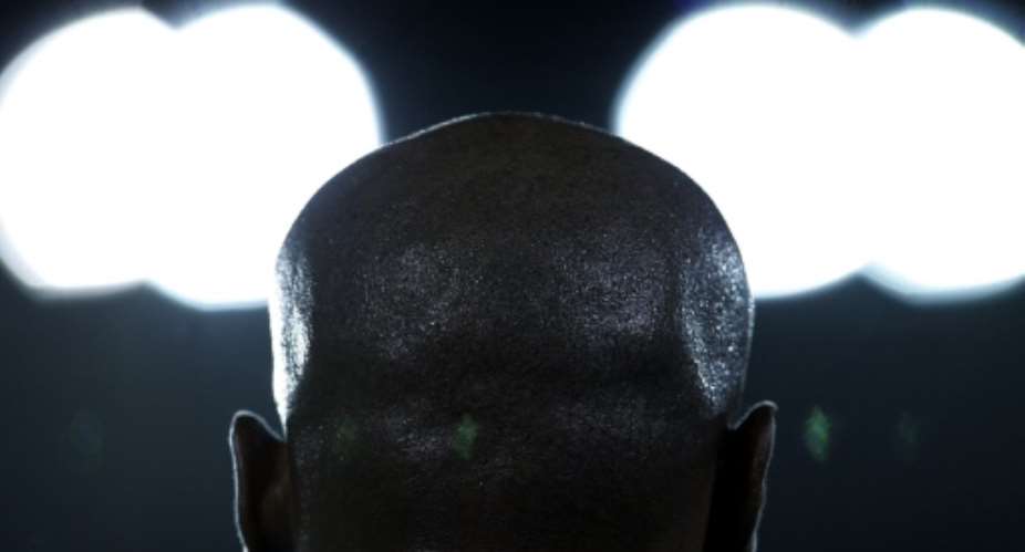 Bald individuals are rich, according to Mozambique superstition and culture.  By MAURICIO LIMA AFP