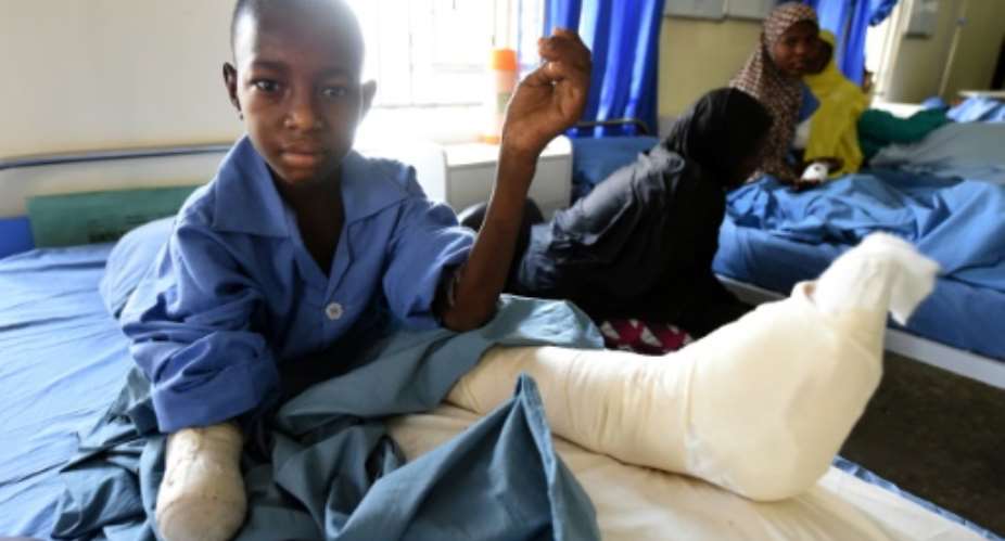Twelve-year-old Isa Lawan sits with a bandaged stump on his right arm after his hand was amputated following injuries from a Boko Haram attack in Maiduguri, capital of northeast Nigerian Borno State.  By Pius Utomi Ekpei AFP