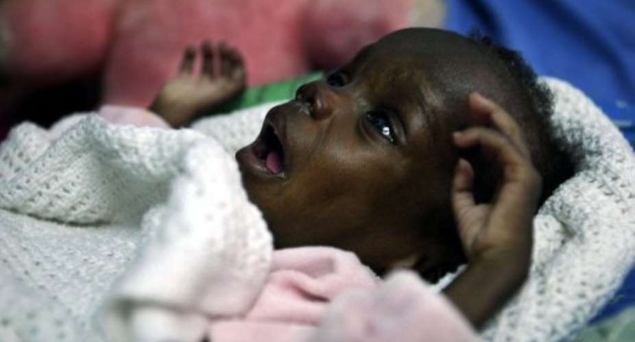 A Ugandan infant named Sonia receives treatment for HIV contracted through her mother in 2003.  By Marco Longari AFPFile