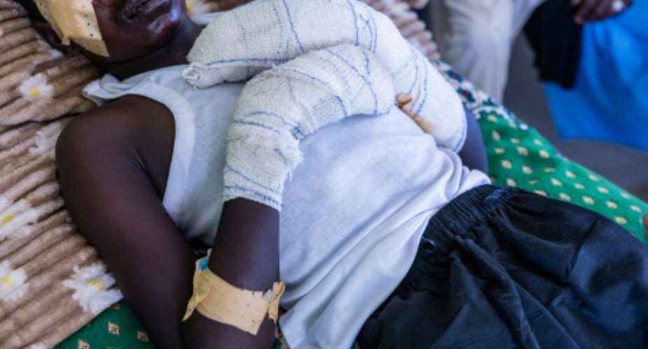 Faouzi Abdulbagi Mahammat Anour, 18, was taken to Chad for treatment after a drone attack while grazing livestock across the border in Sudan.  By Joris Bolomey (AFP)