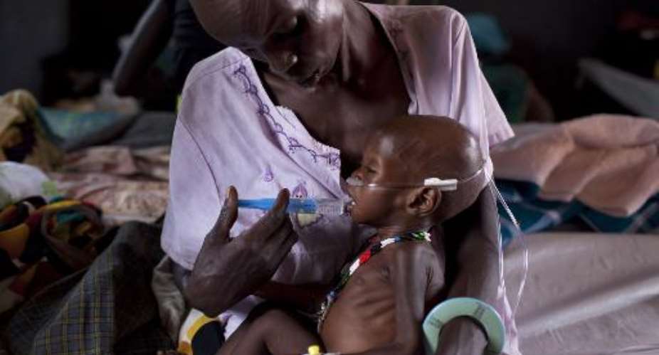A severely malnourished child receives treatment at a medical camp run by international aid group Medecins sans Frontieres, on March 3, 2014 in Minkamman, South Sudan.  By Jm Lopez AFPFile