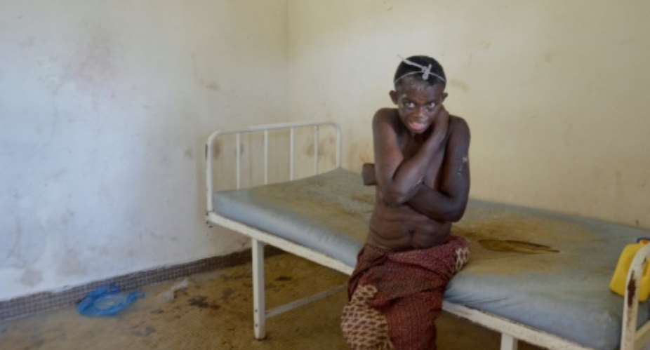 A patient tries to cover her chest as she sits in a decrepit room in Gabon's sole psychiatric hospital, the National Centre for Mental Health in Melen.  By Celia Lebur AFP