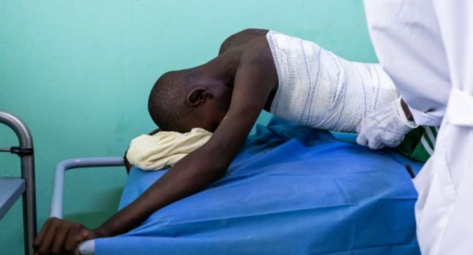 Hissen Ibrahim Abdelmadjid, 15, was treated at a hospital in Tine, Chad, after being caught in a drone attack across the border in Sudan.  By Joris Bolomey (AFP)