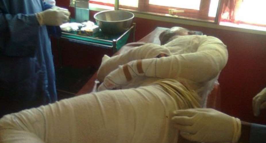 A victim of a petrol tanker fire is treated for burns.  By Osaro Okhomina (AFP)