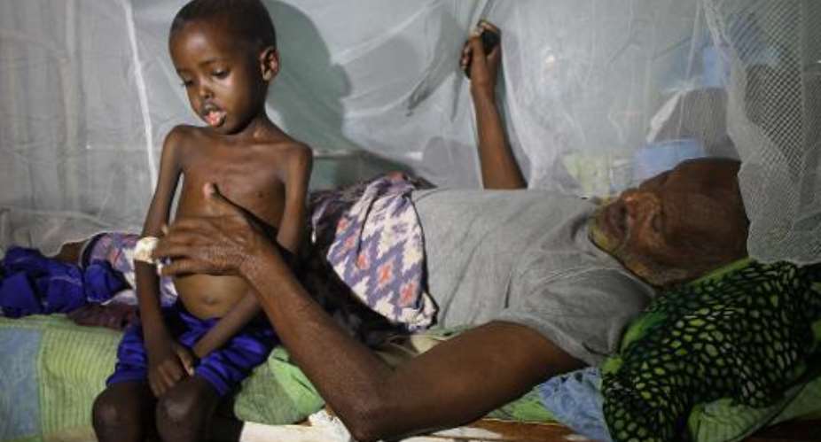 A patient lies on a bed next to a malnourished child at Banadir hospital in Mogadishu on July 15, 2015.  By Abdifitah Hashi Nor AFPFile