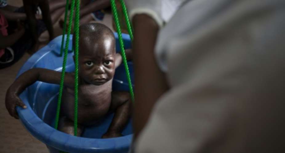 Hunger: A child is weighed at a CAR malnutrition unit.  By FLORENT VERGNES AFPFile