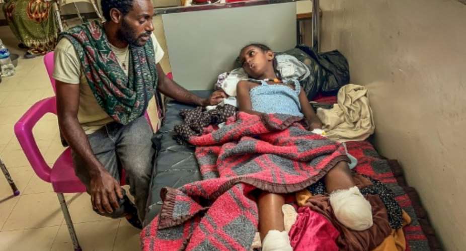 Iyerusalem, 10, lost a leg during bombardments in the conflict.  By - (AFP)