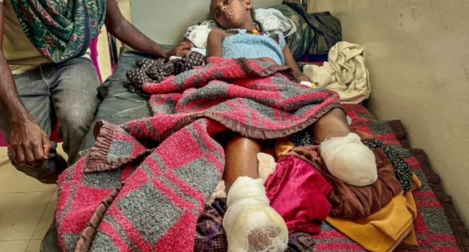 Iyerusalem, 10, needed both legs amputated after heavy shelling in Qarsole, Tigray, that also killed her brother.  By - (AFP)