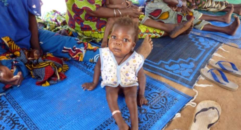 An infant suffering from malnutrition and malaria sits with others as they wait for treatment at an international NGO MSF Doctors Without Boarders outpost in Guidan-Roumdji.  By Boureima Hama AFP