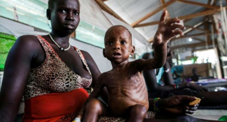 Millions of people are facing severe hunger in South Sudan as a result of the country's disastrous civil war.  By ALBERT GONZALEZ FARRAN cdsAFP