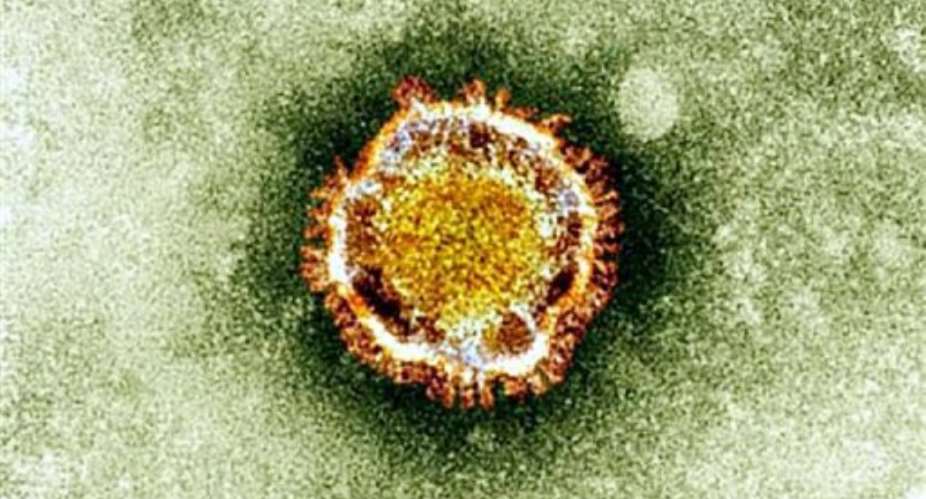 A view of the coronavirus under an electron miscroscope.  By  (British Health Protection Agency/AFP)
