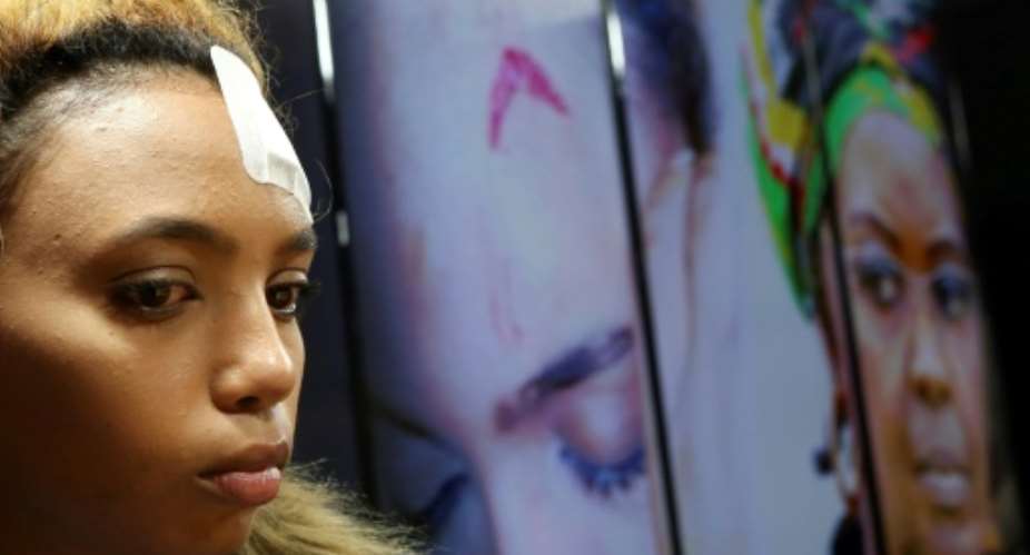 South African model Gabriella Engels has accused Zimbabwe's First Lady Grace Mugabe of beating her with an electrical extension cable at a Johannesburg hotel.  By Phill Magakoe AFP