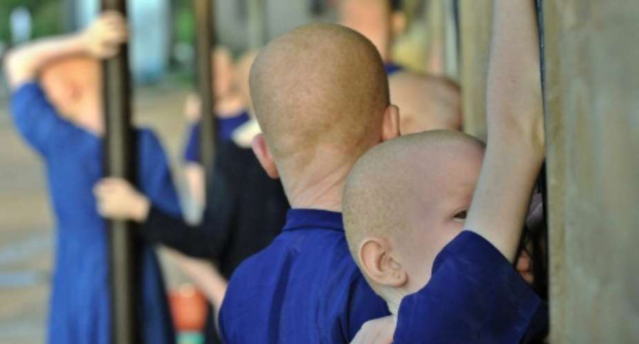 At least 76 albinos have been murdered since 2000 with their dismembered body parts selling for around 600 528 euros and entire bodies fetching 75,000, according to United Nations experts.  By Tony Karumba AFPFile