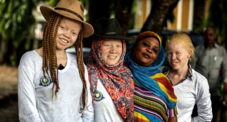 Tanzania's human rights campaigners say the number of attacks against albinos is in sharp decline, but their graves are increasingly being desecrated instead and their remains exhumed.  By BUNYAMIN AYGUN Milliyet DailyAFPFile