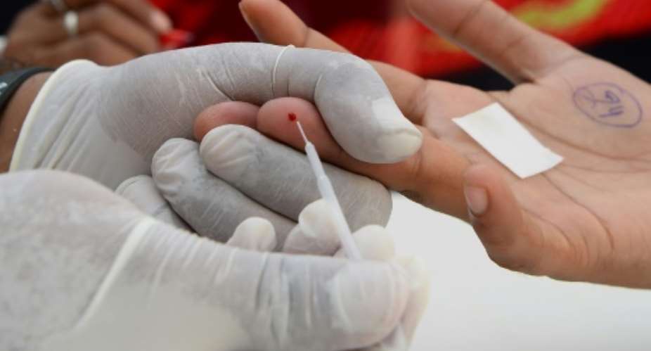 The UN says nearly 37 million people worldwide are infected with HIV which, if left untreated, can lead to AIDS.  By Sajjad HUSSAIN (AFP)