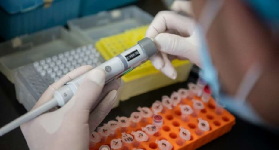 World leaders said a vaccine should not be patented and science should be shared among nations.  By NICOLAS ASFOURI (AFP)