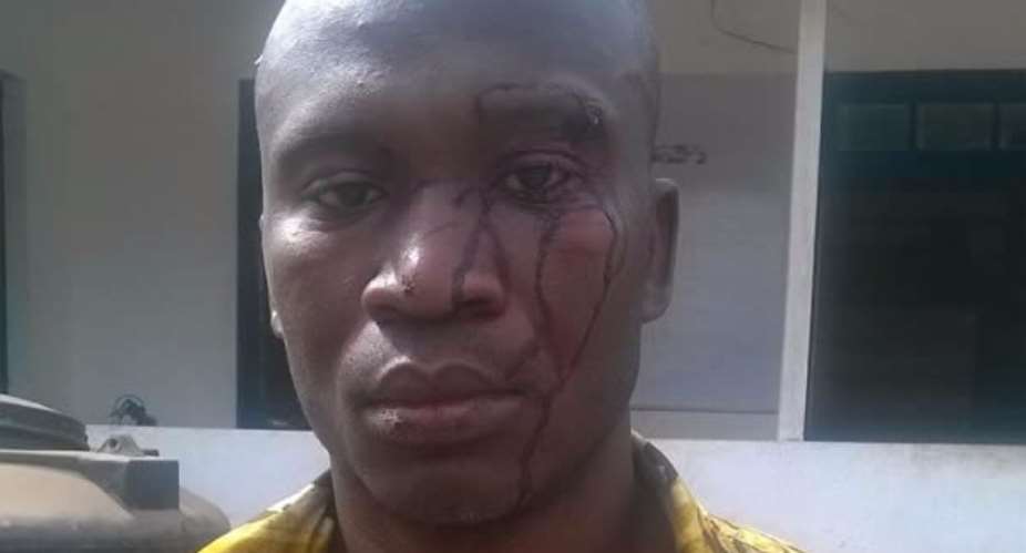 Police release Ghanaian-born US soldier allegedly assaulted at US Embassy