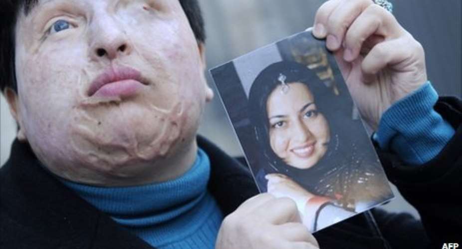 Ameneh Bahrami before and after she was attacked with acid