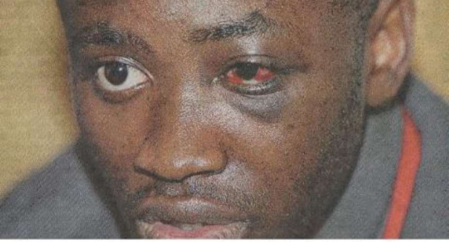 Ghanaian beaten mercilessly by Italian Police