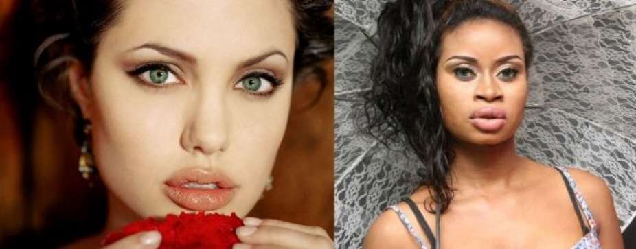 Married Abuja Based Female Artiste, Gina, Pays $85,000 Surgery Fee For Angelina Jolie Lips