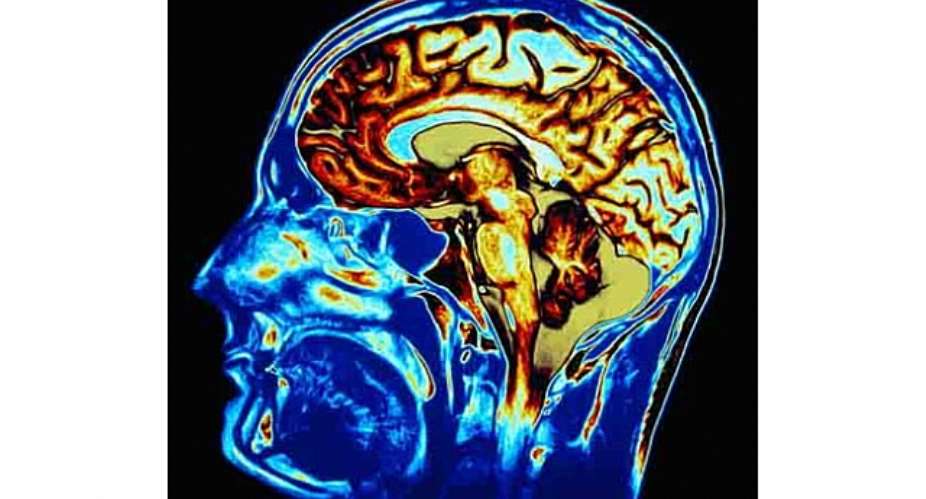 9 Things You Might Not Know Damages The Brain