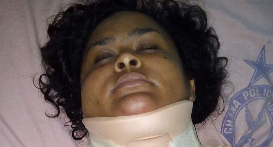 Photo: Actress Vivian Jill Involved in Mild Accident