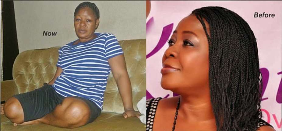 Yoruba Actress, Omotunde Ogundimu Critically Ill, Needs Financial Help