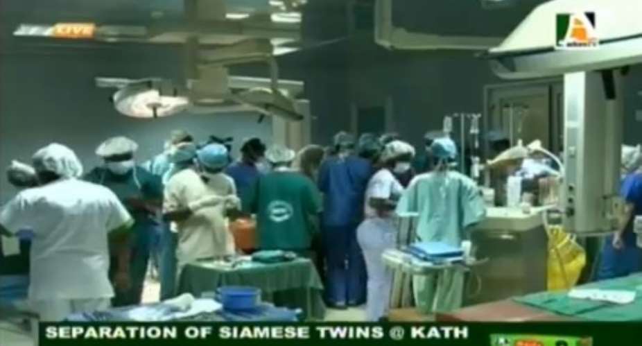 Watch live: Surgery to separate conjoined babies underway